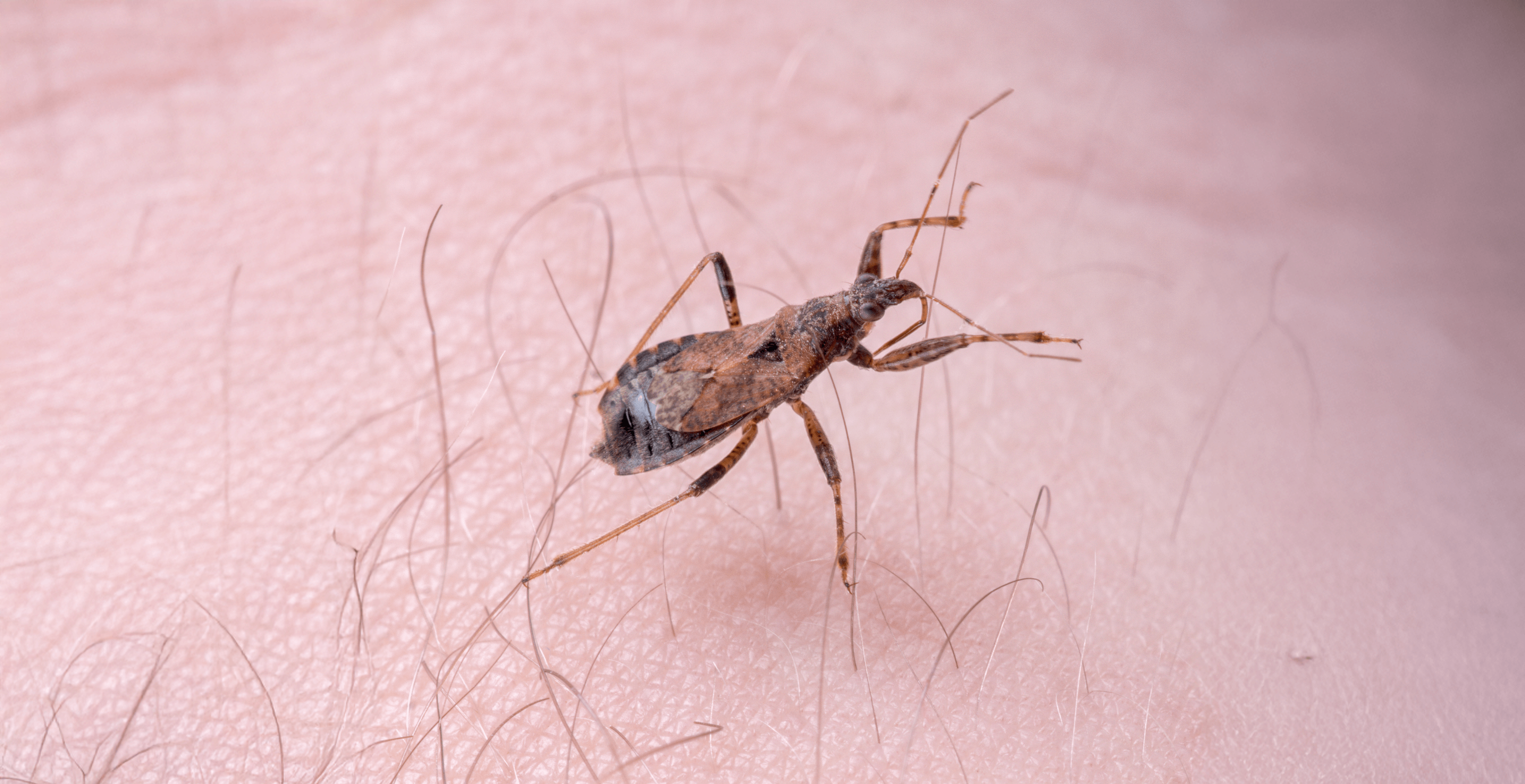 maladie de Chagas